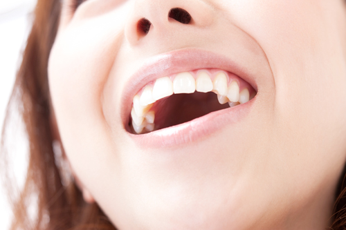 ［画像］銀歯を白い歯に替えるメリット