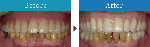 Before After