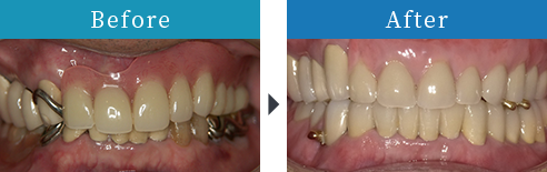 Before After